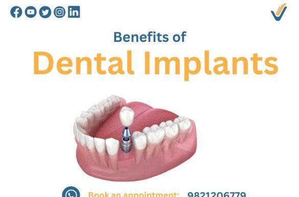 Benefits-of Dental-Implants