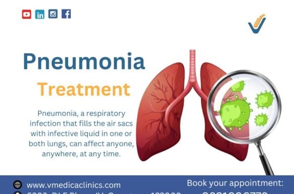 Pneumonia-treatment