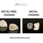 METAL-FREE-vs-METAL-CROWNS