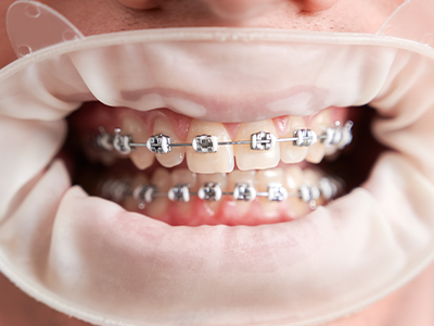 Orthodontists in gurugram